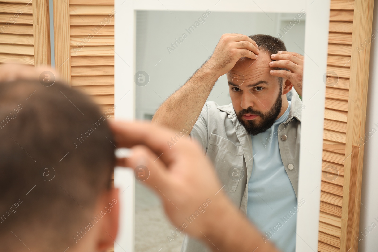 Photo of Baldness problem. Man with receding hairline near mirror at home