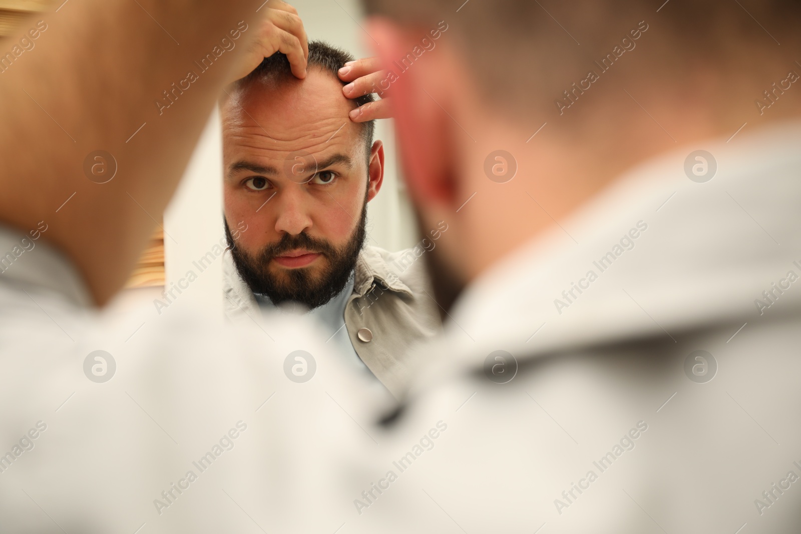 Photo of Baldness problem. Man with receding hairline near mirror at home