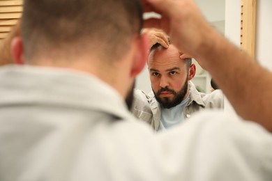 Photo of Baldness problem. Man with receding hairline near mirror at home