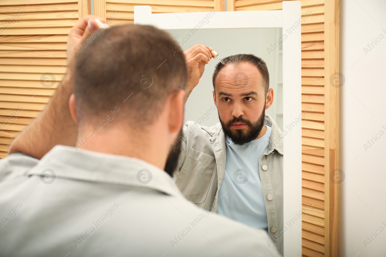 Photo of Baldness treatment. Man applying serum onto his hair near mirror at home