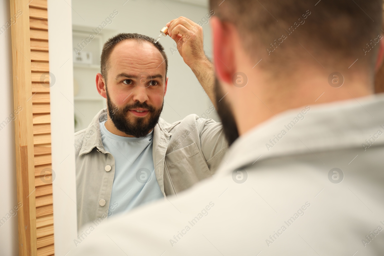 Photo of Baldness treatment. Man applying serum onto his hair near mirror at home