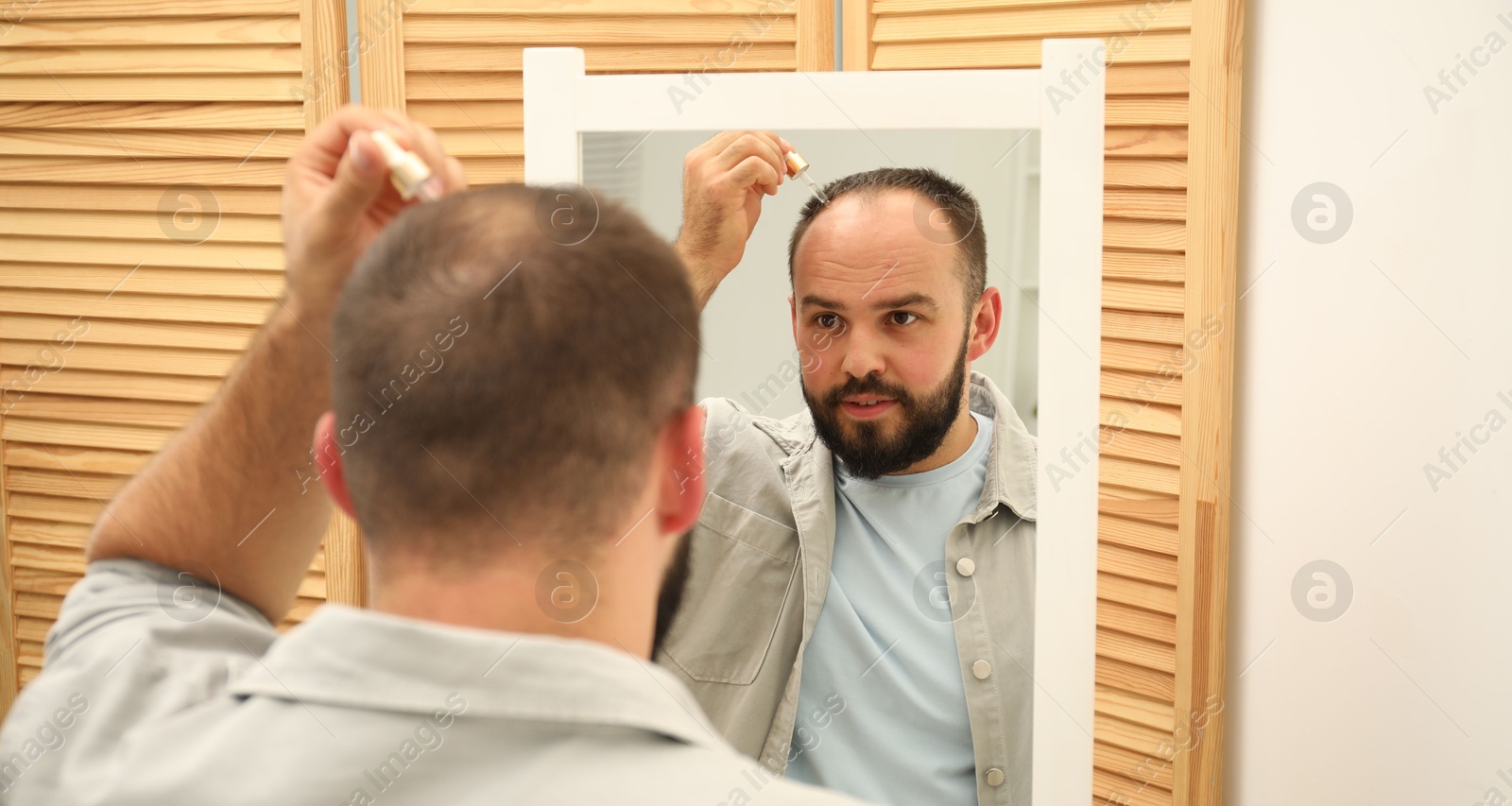 Photo of Baldness treatment. Man applying serum onto his hair near mirror at home