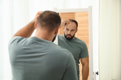 Photo of Baldness problem. Man with receding hairline near mirror at home