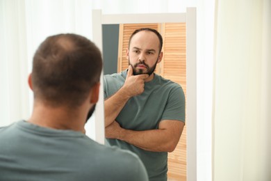 Photo of Baldness problem. Man with receding hairline near mirror at home