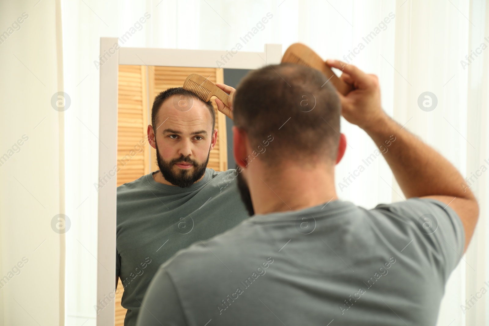 Photo of Baldness problem. Man brushing his hair with comb near mirror at home