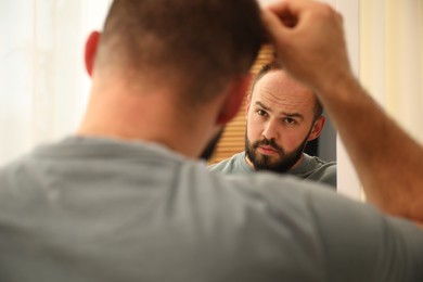 Photo of Baldness problem. Man with receding hairline near mirror at home
