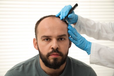 Photo of Baldness problem. Doctor in medical gloves drawing marks on patient's head before hair transplant surgery in clinic, closeup