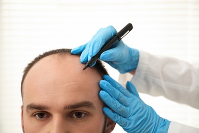 Photo of Baldness problem. Doctor in medical gloves drawing marks on patient's head before hair transplant surgery in clinic, closeup