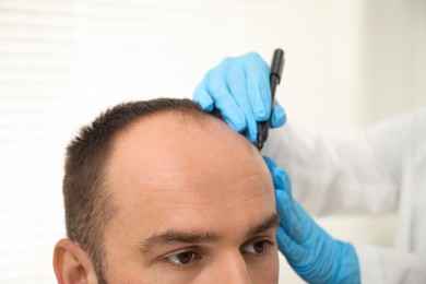Photo of Baldness problem. Doctor in medical gloves drawing marks on patient's head before hair transplant surgery in clinic, closeup