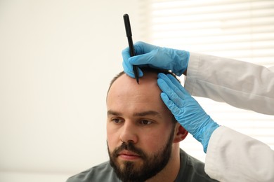 Photo of Baldness problem. Doctor in medical gloves drawing marks on patient's head before hair transplant surgery in clinic, closeup. Space for text