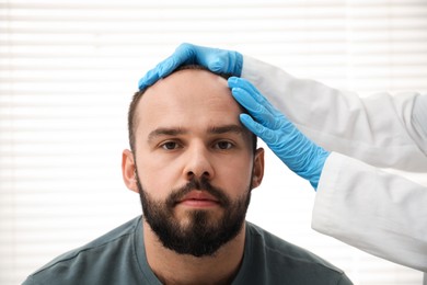 Photo of Baldness problem. Doctor in medical gloves examining patient's head in clinic, closeup