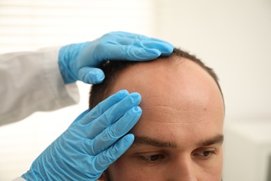 Photo of Baldness problem. Doctor in medical gloves examining patient's head in clinic, closeup
