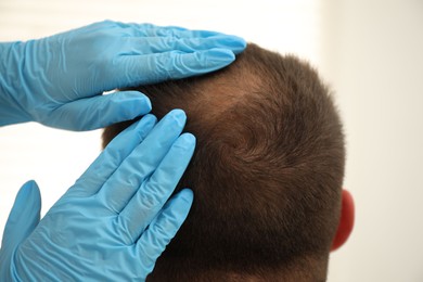 Photo of Baldness problem. Doctor in medical gloves examining patient's head in clinic, closeup