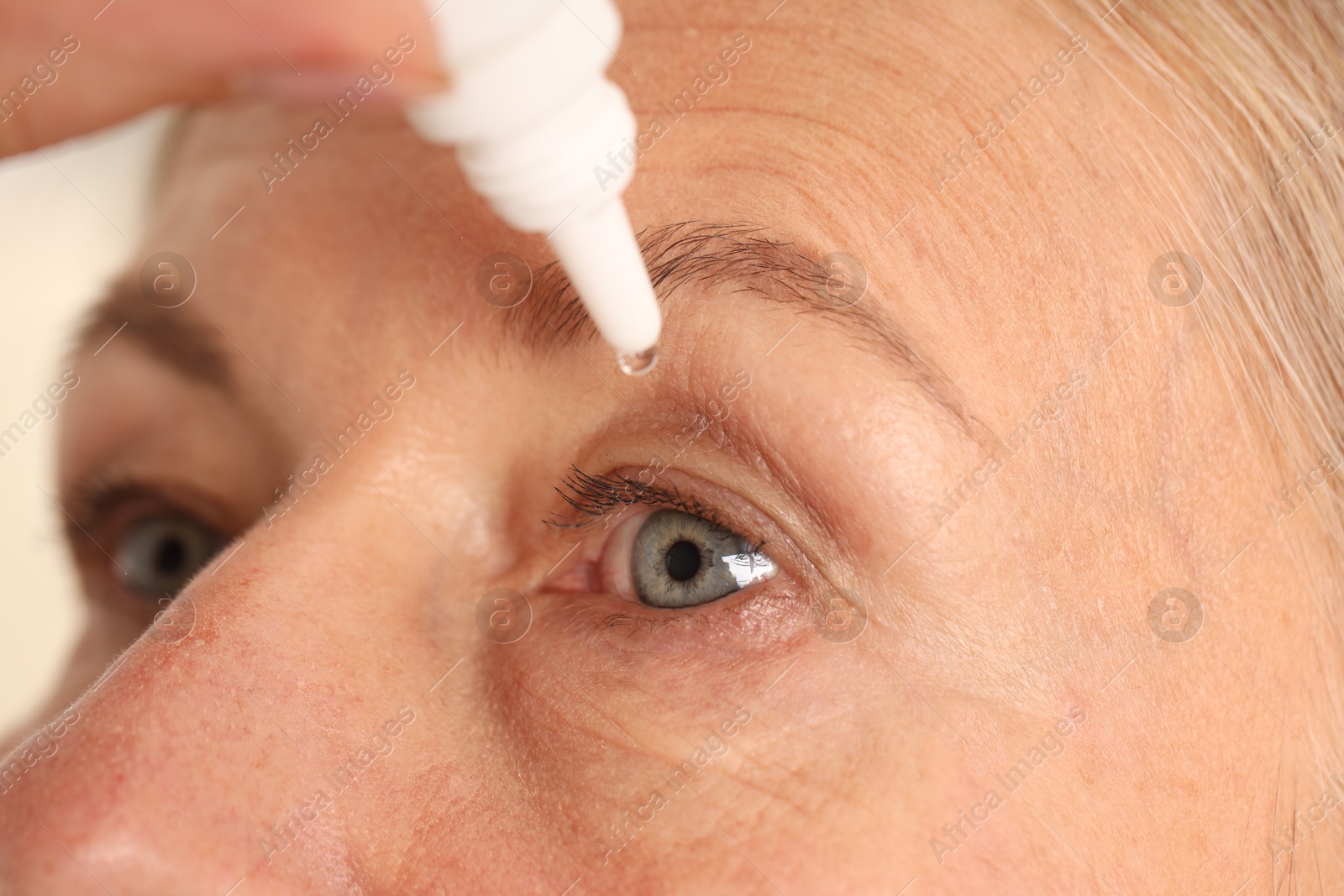 Photo of Woman applying eye drops on light background, closeup