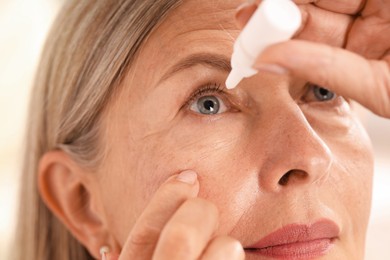 Photo of Woman applying eye drops on light background, closeup
