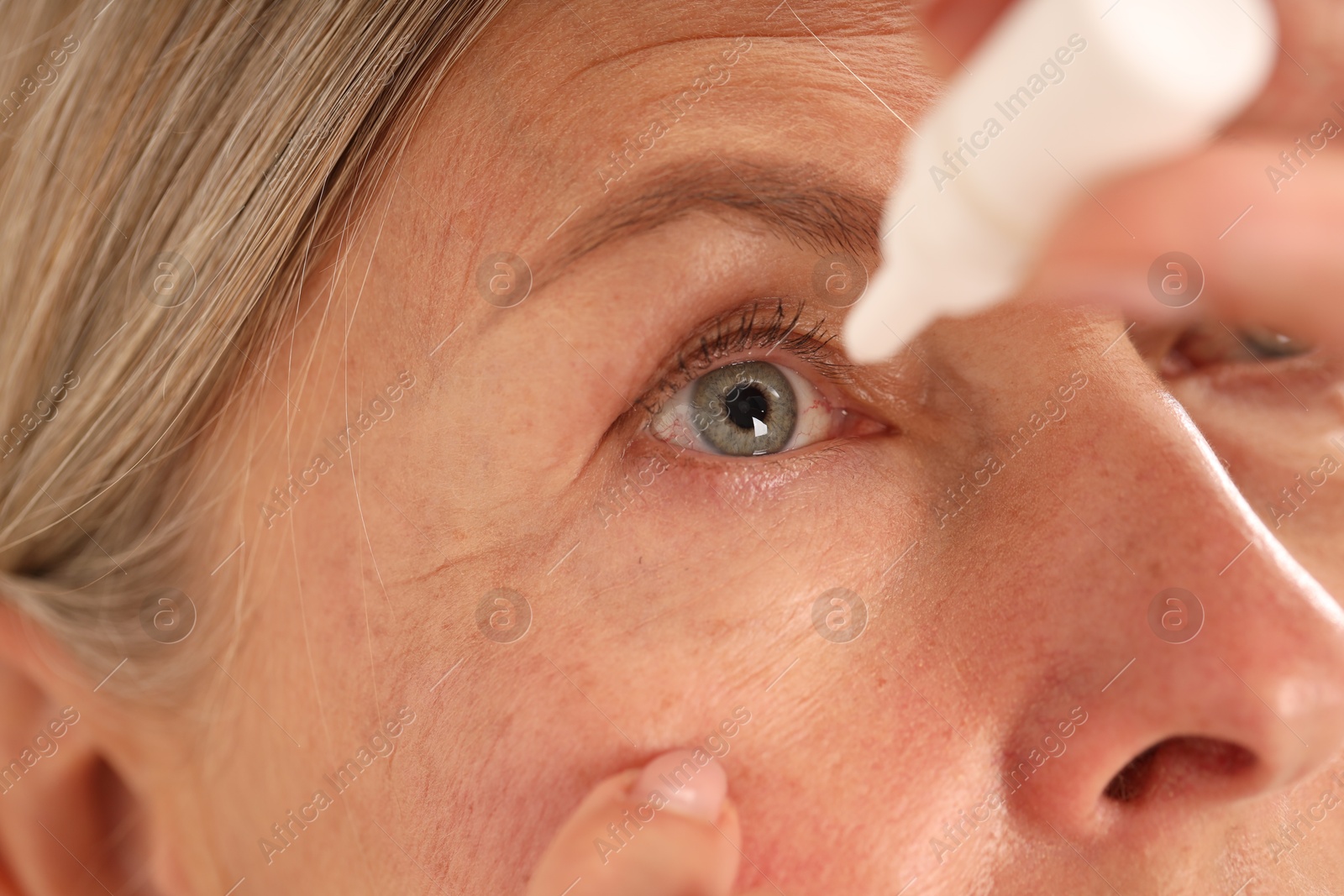 Photo of Senior woman applying eye drops, closeup view