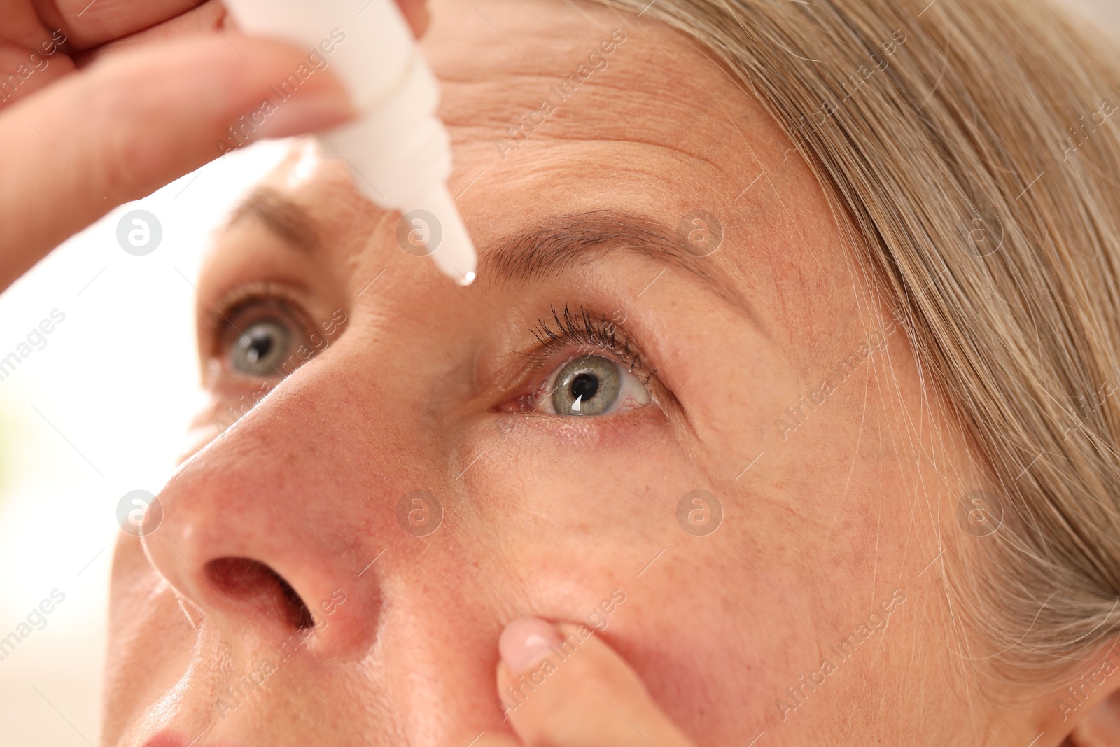 Photo of Woman applying eye drops on light background, closeup