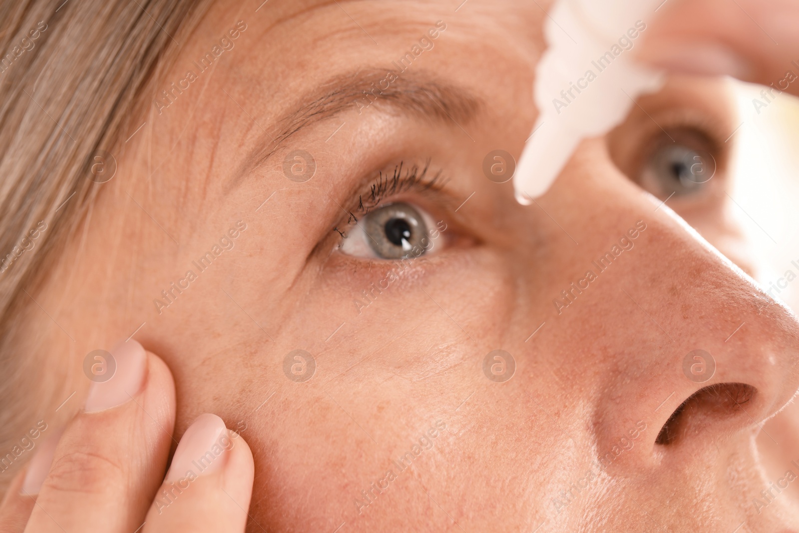 Photo of Woman applying eye drops on light background, closeup