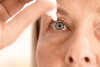 Photo of Woman applying eye drops on light background, closeup
