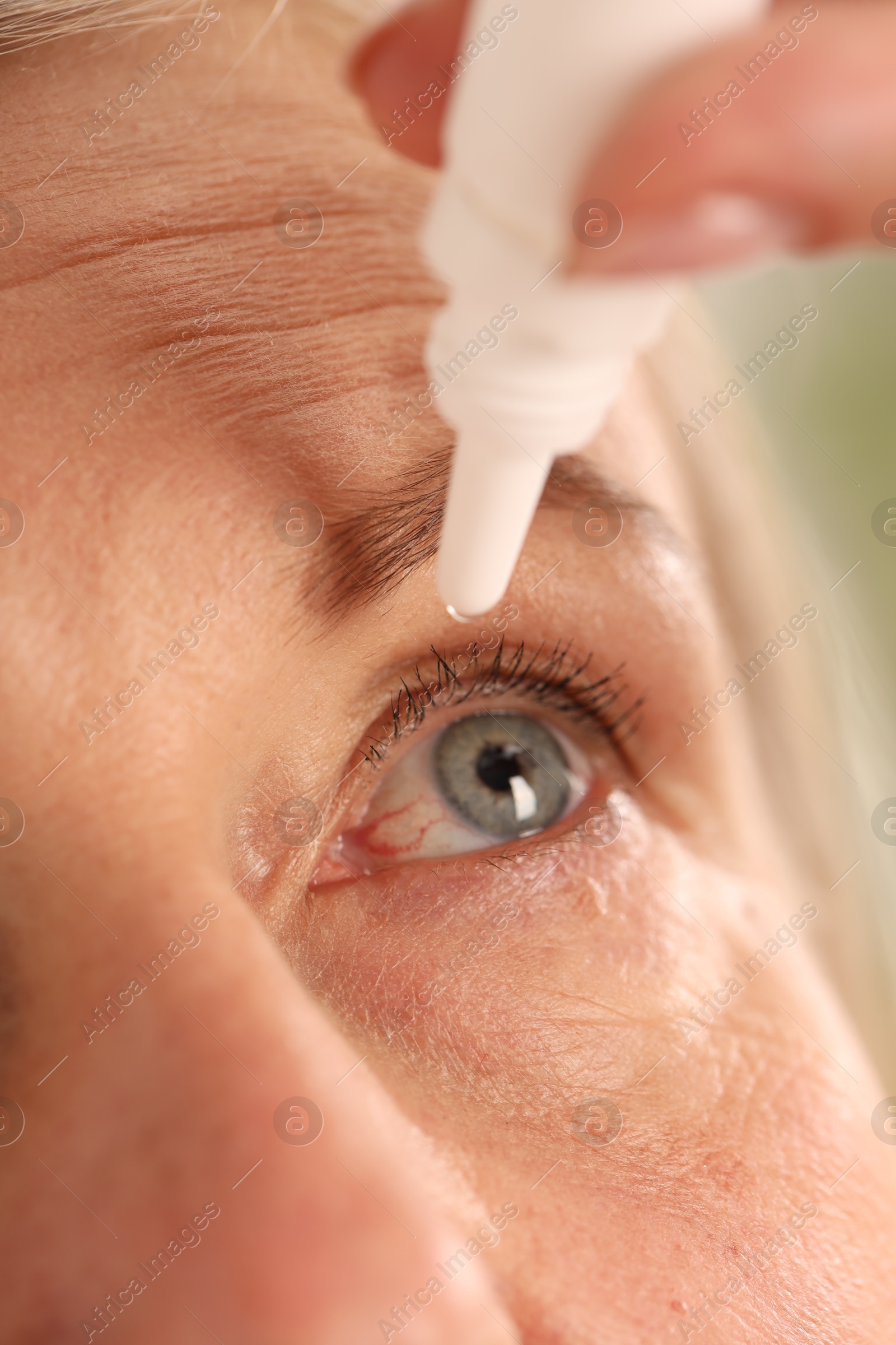 Photo of Woman applying eye drops on blurred background, closeup