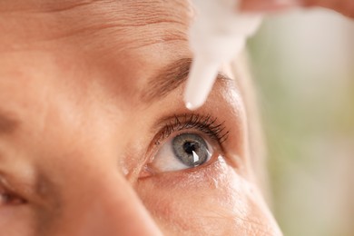 Photo of Woman applying eye drops on blurred background, closeup