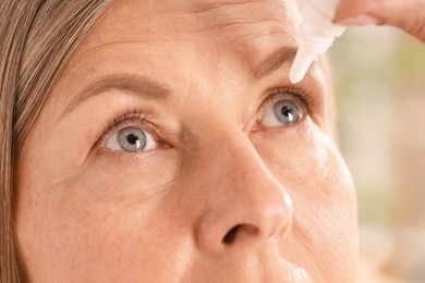 Photo of Woman applying eye drops on blurred background, closeup