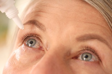 Photo of Woman applying eye drops on blurred background, closeup