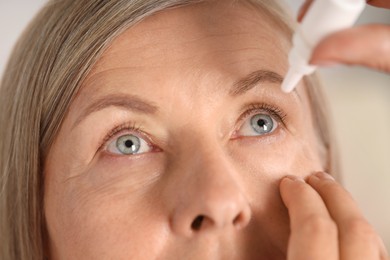 Photo of Woman applying eye drops on blurred background, closeup