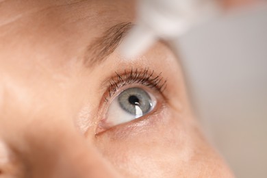 Photo of Woman applying eye drops on blurred background, closeup