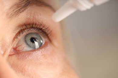 Photo of Woman applying eye drops on blurred background, closeup