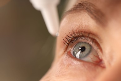 Photo of Woman applying eye drops on blurred background, closeup