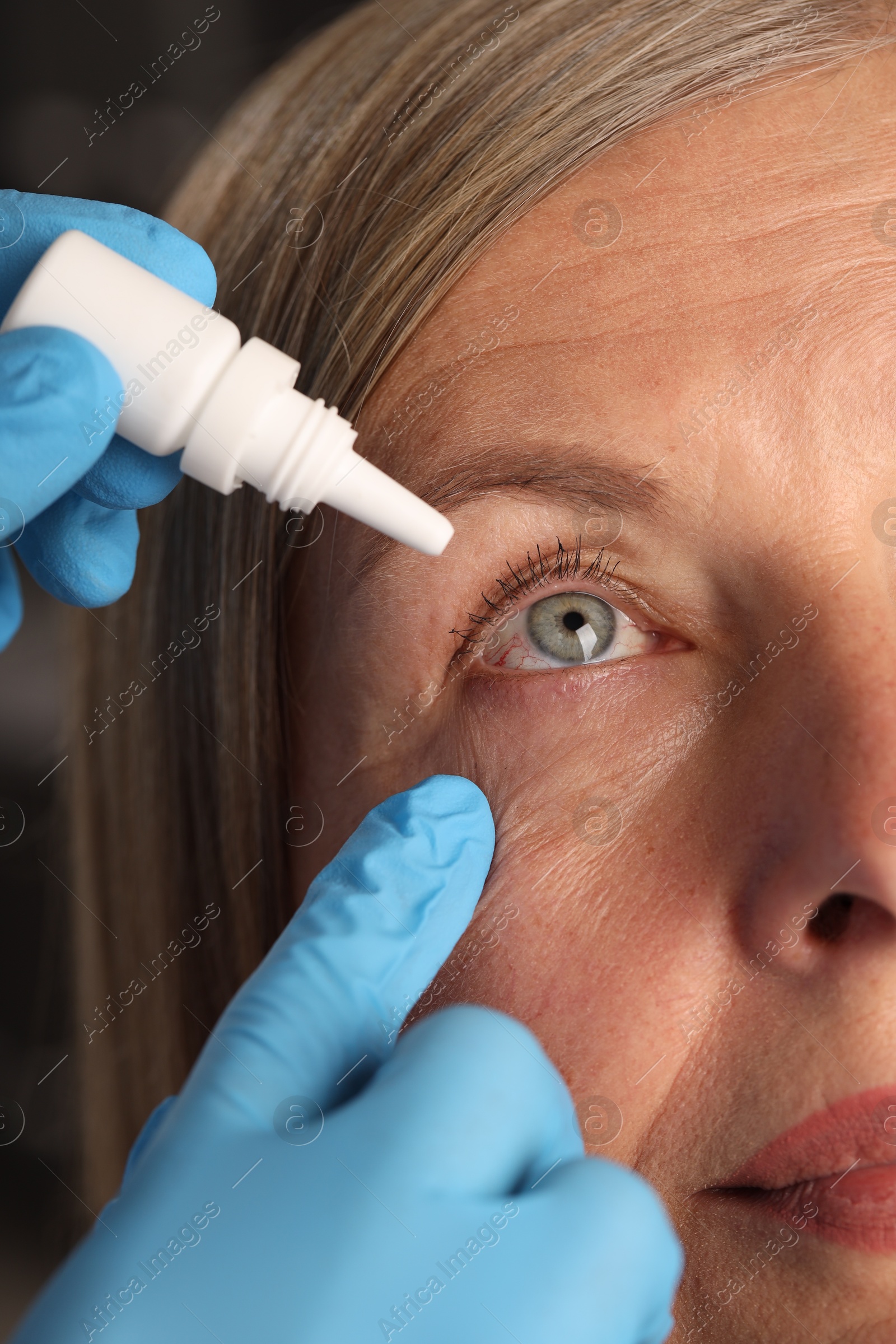 Photo of Doctor putting drops into woman's eye indoors, closeup