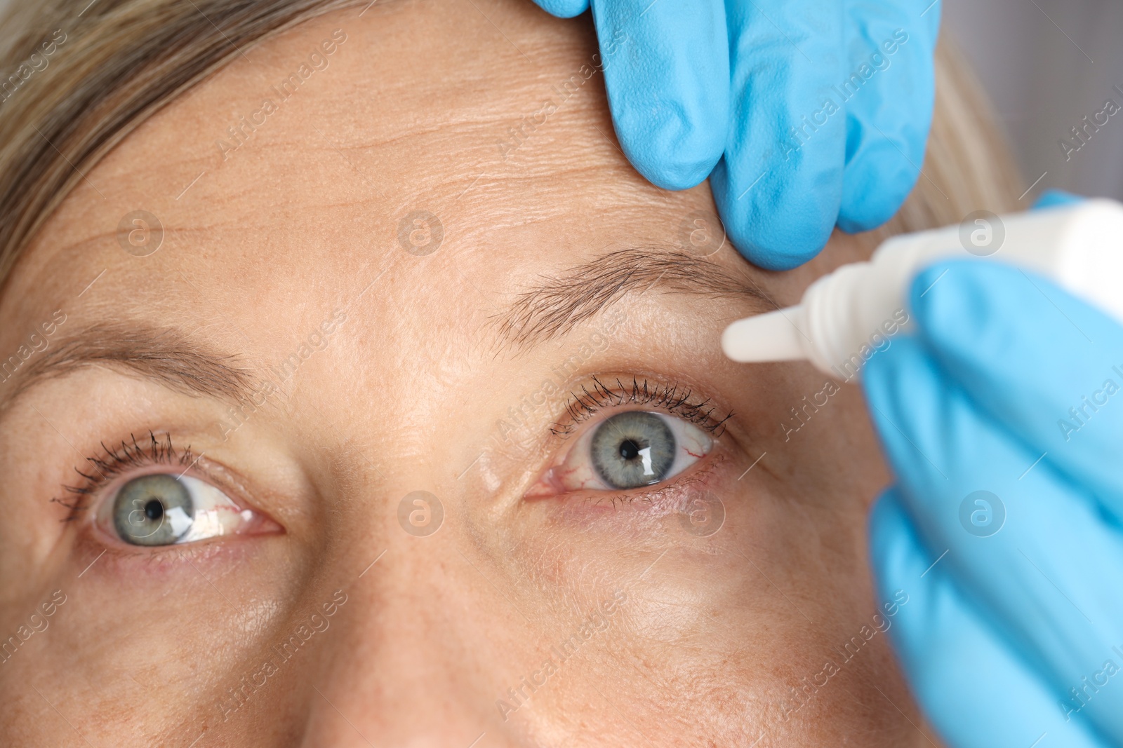 Photo of Doctor putting drops into woman's eye indoors, closeup