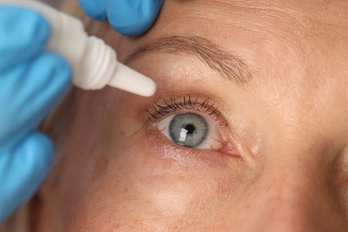 Photo of Doctor putting drops into woman's eye, closeup