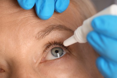 Photo of Doctor putting drops into woman's eye indoors, closeup