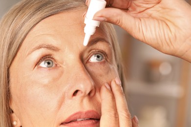 Photo of Woman applying eye drops on blurred background, closeup