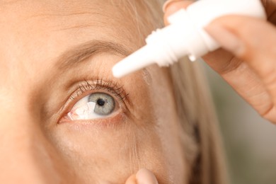 Photo of Woman applying eye drops on blurred background, closeup