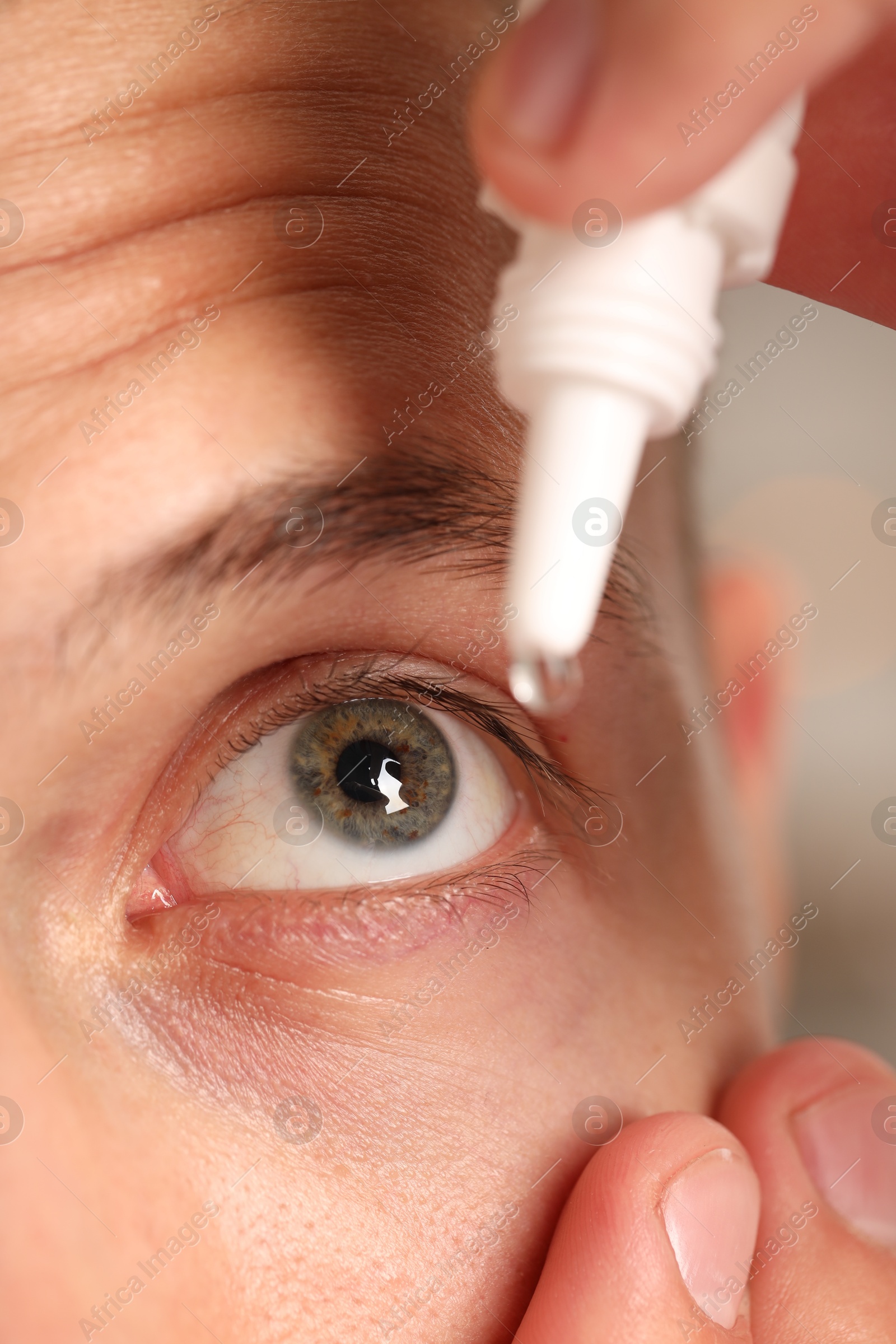 Photo of Man applying eye drops on blurred background, closeup