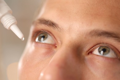 Photo of Man applying eye drops on blurred background, closeup