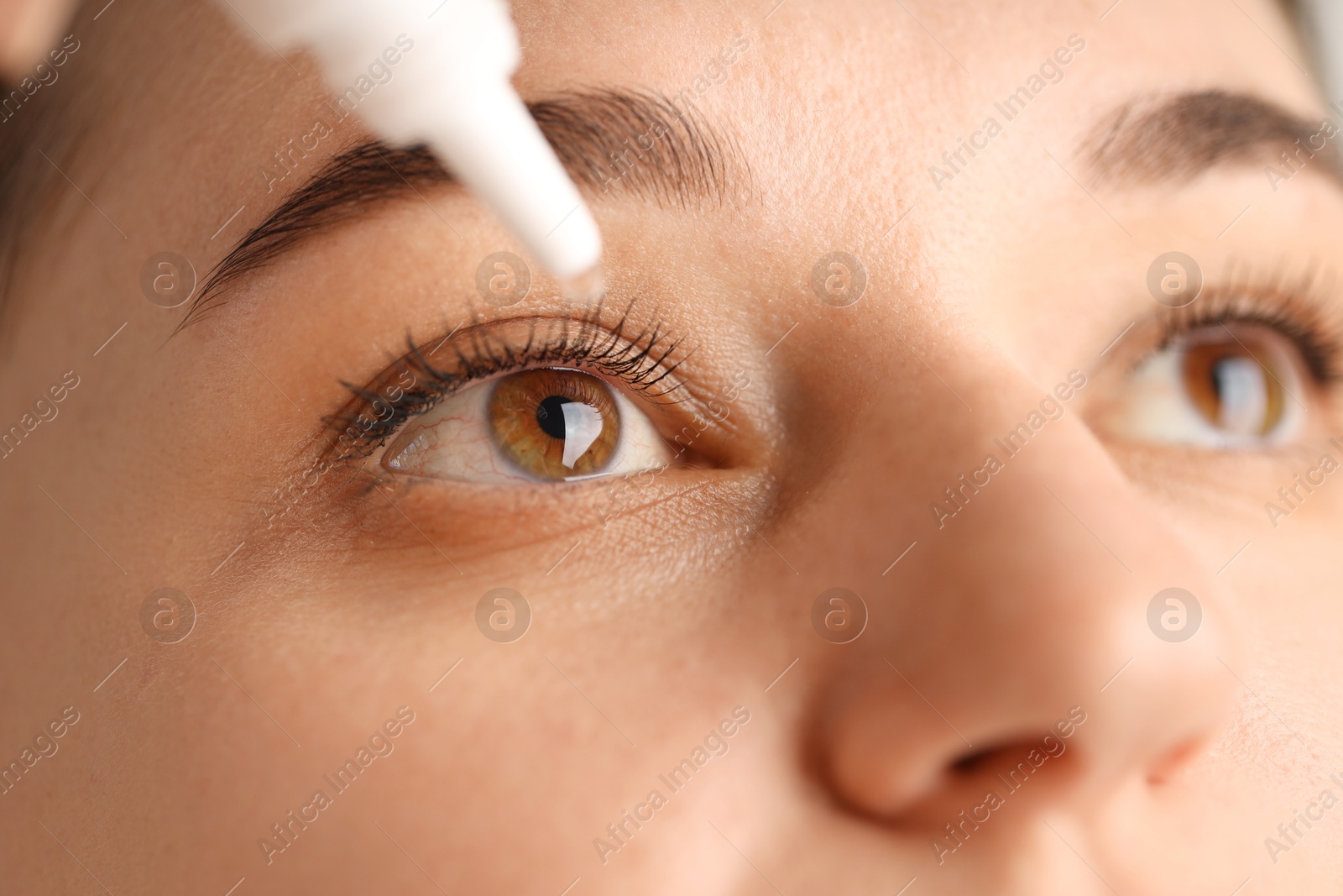 Photo of Young woman applying eye drops, closeup view