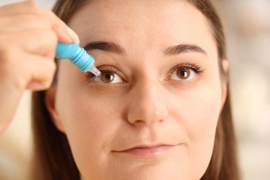 Photo of Woman applying eye drops on blurred background, closeup