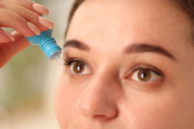 Photo of Woman applying eye drops on blurred background, closeup