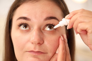 Photo of Woman applying eye drops on blurred background, closeup