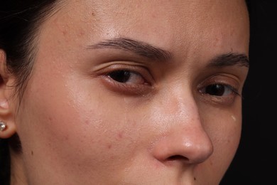 Photo of Sad woman crying on black background, closeup