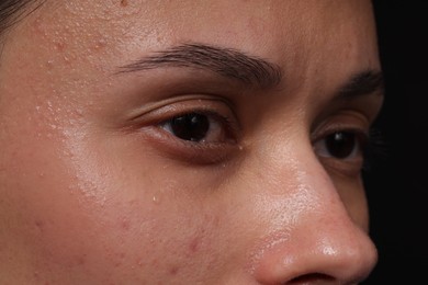 Photo of Sad woman crying on black background, closeup
