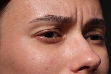 Photo of Closeup view of sad young woman crying