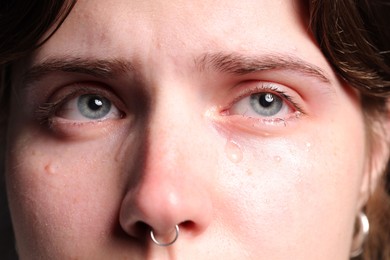 Photo of Closeup view of sad young woman crying