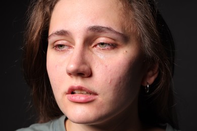 Photo of Sad woman crying on black background, closeup
