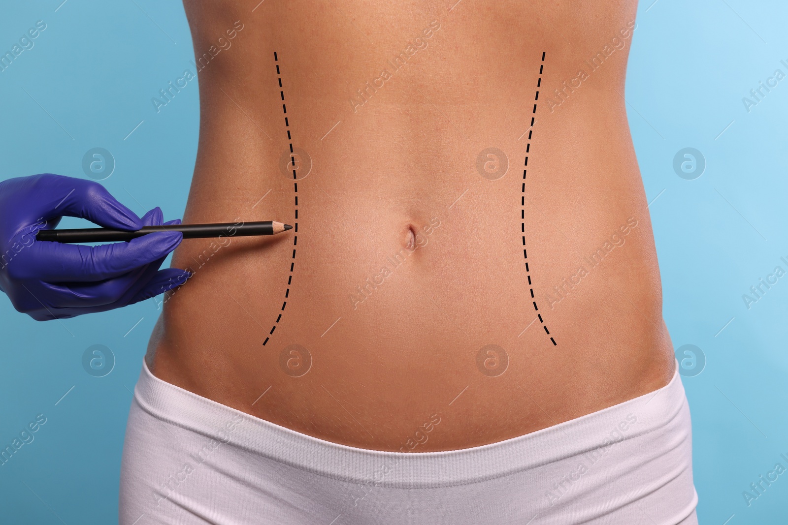 Image of Woman preparing for cosmetic surgery, light blue background. Doctor drawing markings on her abdomen, closeup