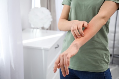 Woman with allergy symptoms scratching forearm indoors, closeup. Space for text